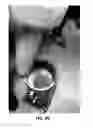 Fig. 17 - PROSTHESIS COOLING LINER SYSTEM