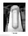 Fig. 19 - PROSTHESIS COOLING LINER SYSTEM
