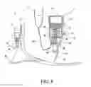 Fig. 05 - Vacuum assisted suspension system