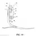 Fig. 07 - Vacuum assisted suspension system