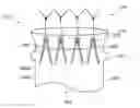Fig. 01 - Low profile stent and delivery system
