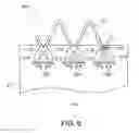 Fig. 07 - Low profile stent and delivery system