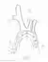 Fig. 10 - Frame structures, stent grafts incorporating the same, and methods for extended aortic repair