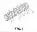 Fig. 02 - STENT AND PROCESS FOR PRODUCING SAME