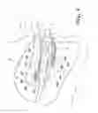 Fig. 06 - WEIGHT LOSS DEVICE