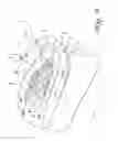 Fig. 11 - WEIGHT LOSS DEVICE