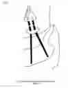 Fig. 14 - FOOT DROP DEVICE