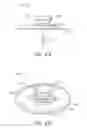 Fig. 05 - CANNULA INSERTION SUSTAINING SYSTEMS AND DEVICES
