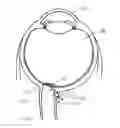 Fig. 01 - Optic Nerve Implants