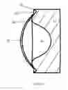 Fig. 04 - Contact lens tool kit and method of using