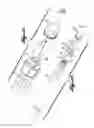Fig. 10 - Intraocular irrigator-aspirator tip component
