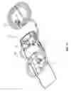 Fig. 17 - Valve system of surgical cassette manifold, system, and methods thereof