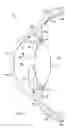 Fig. 02 - Intraocular pressure sensing system for posterior segment drainage