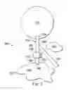 Fig. 03 - Intraocular pressure sensing system for posterior segment drainage