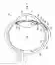 Fig. 05 - Intraocular pressure sensing system for posterior segment drainage