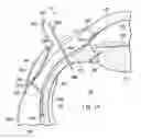 Fig. 09 - Intraocular pressure sensing system for posterior segment drainage