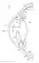 Fig. 02 - Devices, systems and methods for posterior segment drainage