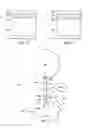 Fig. 03 - Devices, systems and methods for posterior segment drainage