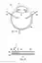 Fig. 09 - Devices, systems and methods for posterior segment drainage