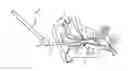 Fig. 01 - AURAL FOREIGN BODY REMOVAL DEVICE AND RELATED METHODS OF USE AND MANUFACTURE
