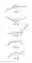 Fig. 03 - AURAL FOREIGN BODY REMOVAL DEVICE AND RELATED METHODS OF USE AND MANUFACTURE
