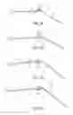 Fig. 04 - AURAL FOREIGN BODY REMOVAL DEVICE AND RELATED METHODS OF USE AND MANUFACTURE
