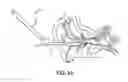 Fig. 05 - AURAL FOREIGN BODY REMOVAL DEVICE AND RELATED METHODS OF USE AND MANUFACTURE
