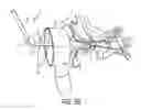 Fig. 08 - AURAL FOREIGN BODY REMOVAL DEVICE AND RELATED METHODS OF USE AND MANUFACTURE
