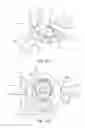 Fig. 15 - Protective dressing for skin-placed medical device