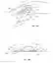 Fig. 17 - Protective dressing for skin-placed medical device