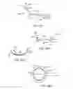 Fig. 43 - CONFORMABLE THERAPEUTIC SHIELD FOR VISION AND PAIN