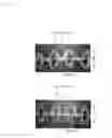 Fig. 17 - Elastic structure for absorbent article and method for manufacturing elastic structure for absorbent article