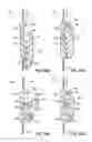 Fig. 22 - Patient repositioning system