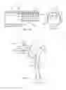 Fig. 06 - System for percutaneously administering reduced pressure treatment using balloon dissection