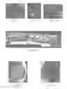 Fig. 08 - System for percutaneously administering reduced pressure treatment using balloon dissection