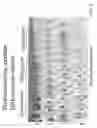 Fig. 03 - Activated micro-bubble based root canal disinfection