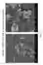 Fig. 18 - Activated micro-bubble based root canal disinfection