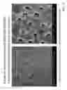 Fig. 20 - Activated micro-bubble based root canal disinfection