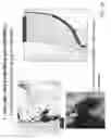 Fig. 25 - Activated micro-bubble based root canal disinfection