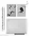 Fig. 26 - Activated micro-bubble based root canal disinfection