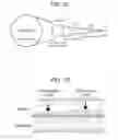 Fig. 04 - METHOD FOR TESTING RISK OF MULTIPLE SYSTEM ATROPHY, TEST KIT, AND DRUG FOR THE TREATMENT OR PREVENTION OF MULTIPLE SYSTEM ATROPHY