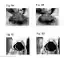 Fig. 06 - ADHESION PREVENTING AGENT