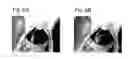 Fig. 07 - ADHESION PREVENTING AGENT