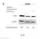 Fig. 10 - SERCA INHIBITOR AND CALMODULIN ANTAGONIST COMBINATION