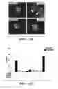 Fig. 35 - METHODS FOR TREATING IMMUNE DISEASES