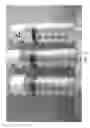 Fig. 04 - HOLLOW PARTICLES ENCAPSULATING A BIOLOGICAL GAS AND METHODS OF USE