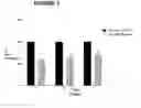 Fig. 02 - USE OF XENON FOR LIMITING TUMOR CELL MIGRATION