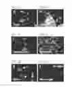 Fig. 07 - Compositions and methods for cardiac tissue repair