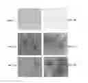Fig. 03 - bacteriophage and uses thereof