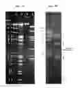 Fig. 04 - bacteriophage and uses thereof